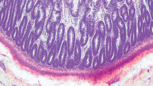 Cámara Digital de Microscopía - Digital Sight 1000 (Nikon) - Imagen 4